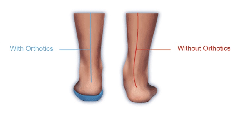 Advanced Boot Fitting Techniques